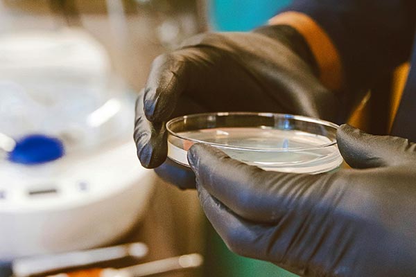 Lab test in petri-dish